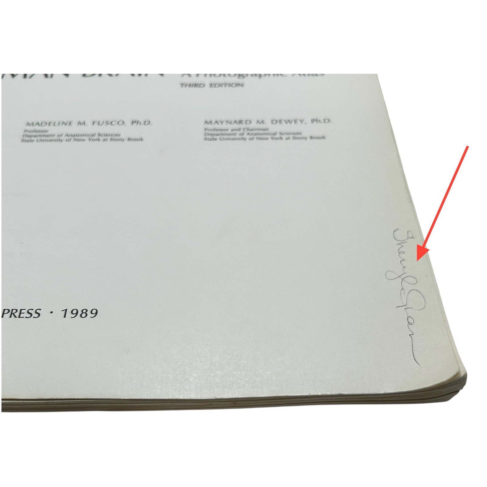 Structure of the Human Brain A Photographic Atlas Third Edition Textbook