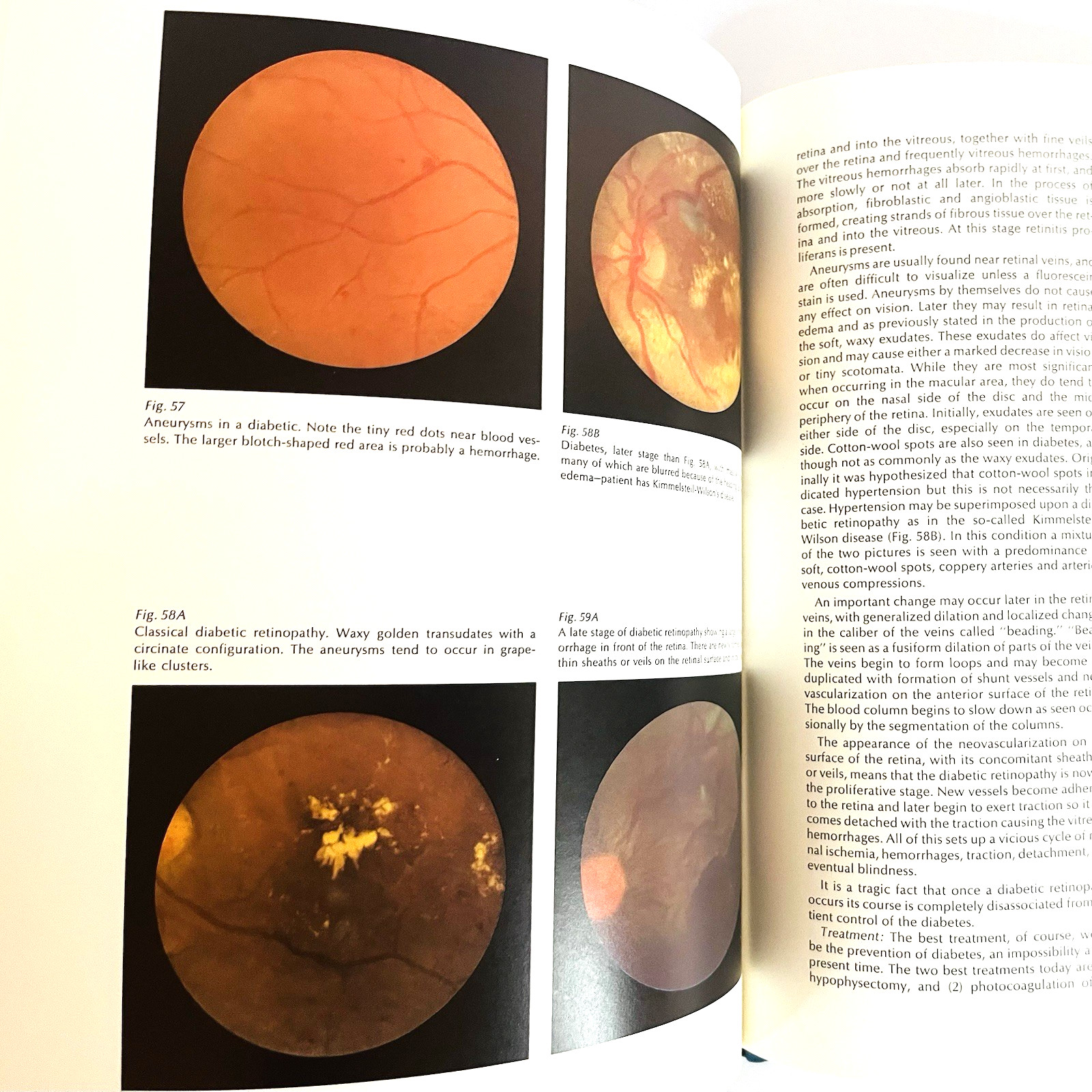 Vintage Monograph on the Fundamentals of Ophthalmoscopy Book Hardcover 1971