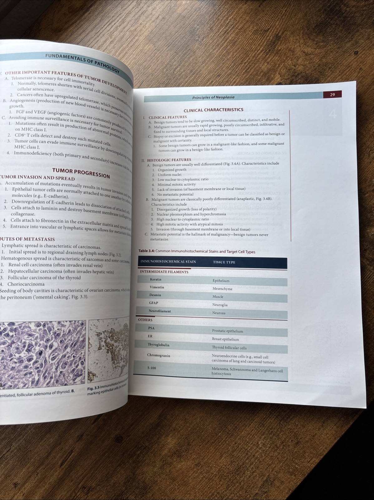 Fundamentals of Pathology 2022 by Hussain A. Sattar Illustrated Medical Textbook