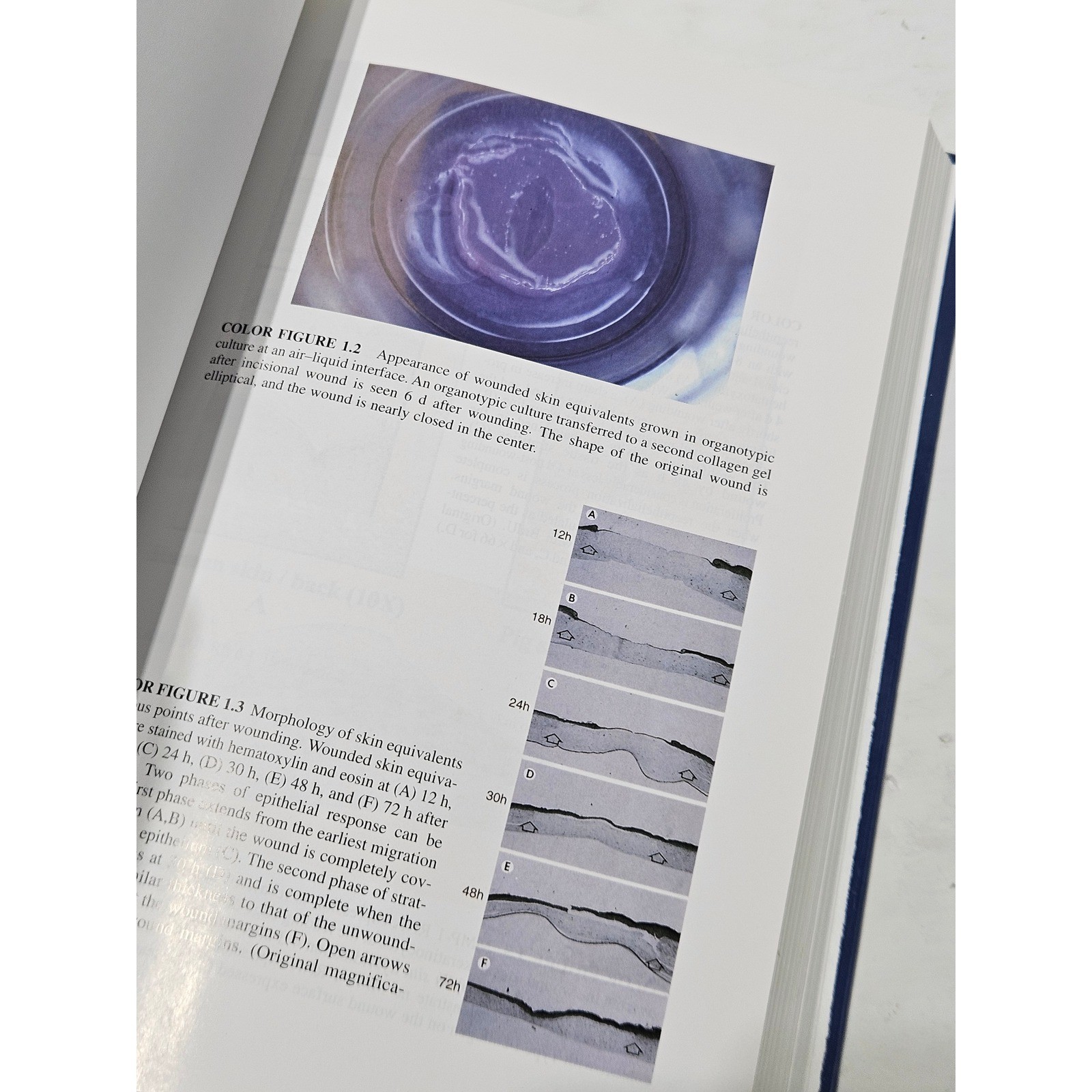 The Epidermis in Wound Healing Dermatology Clinical CRC Press Hardcover