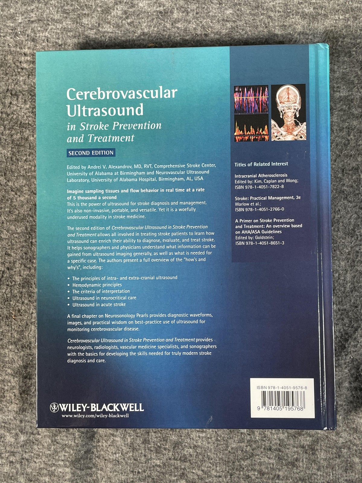 Cerebrovascular Ultrasound Stroke Prevention 2nd Ed Alexandrov Paperback
