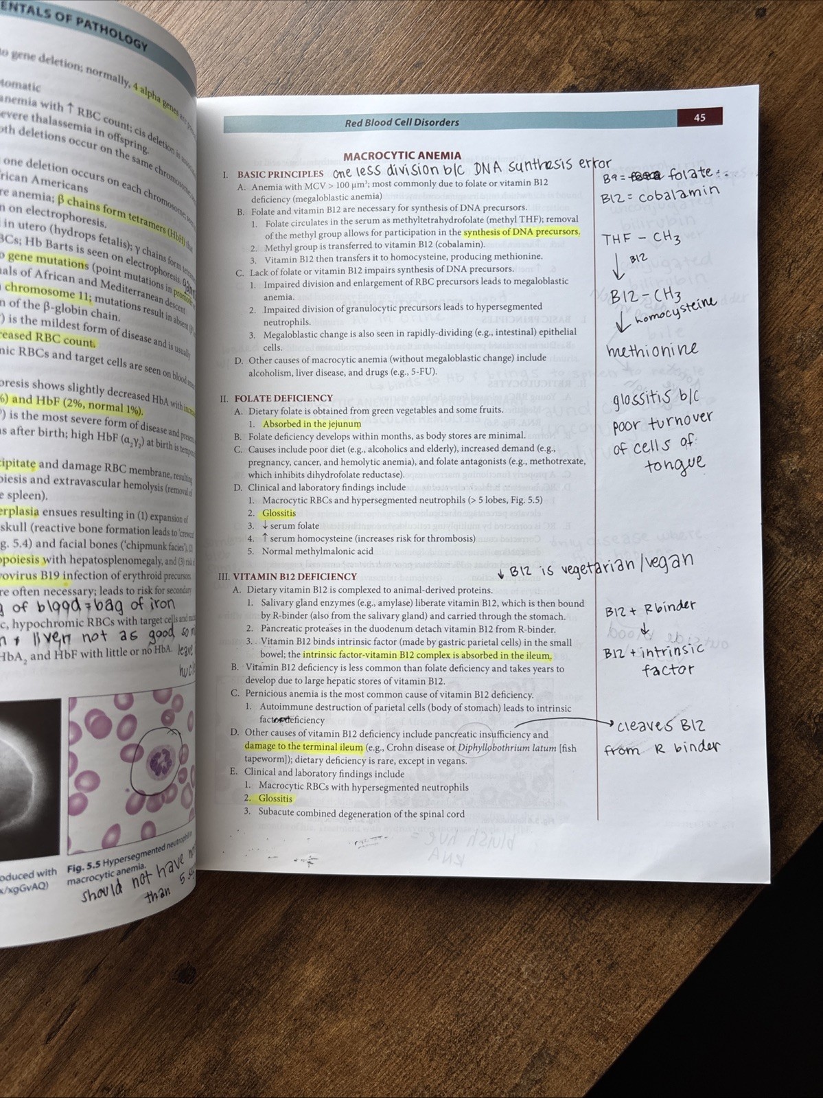 Fundamentals of Pathology 2022 by Hussain A. Sattar Illustrated Medical Textbook