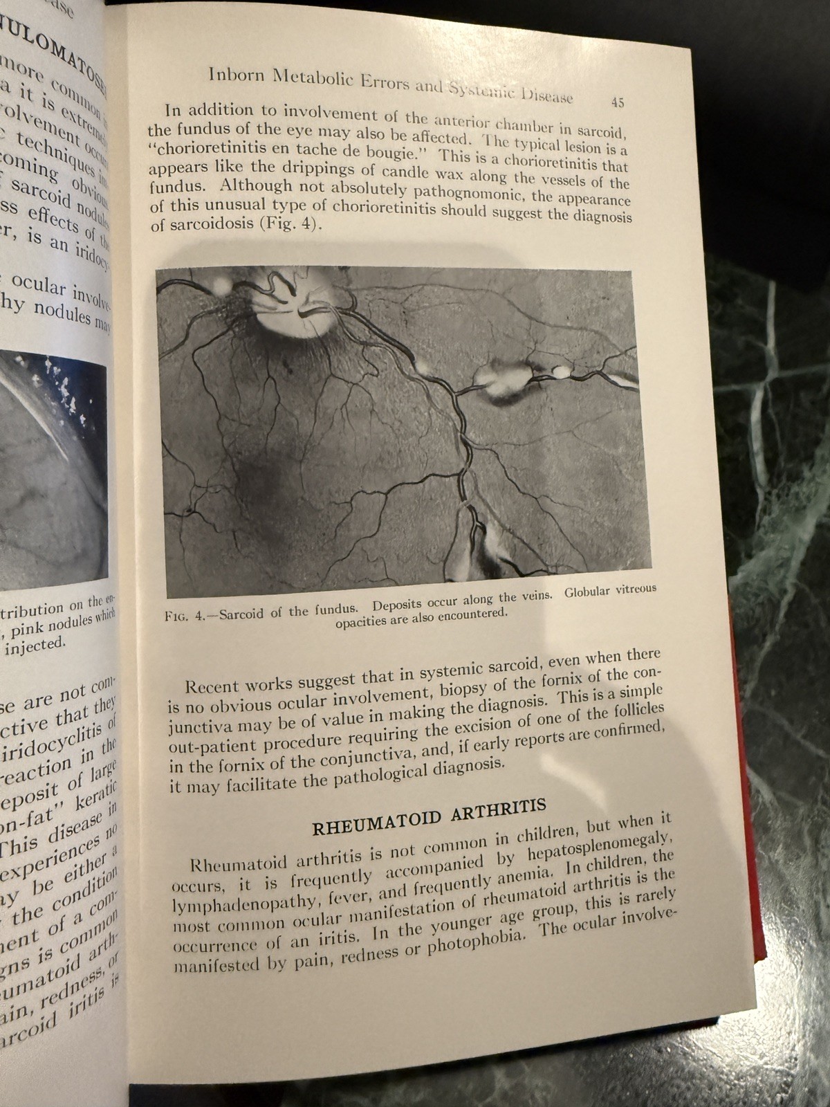 Pediatric Ophthalmology by L Byerly Holt Hardcover Book 1964 Excellent Cond