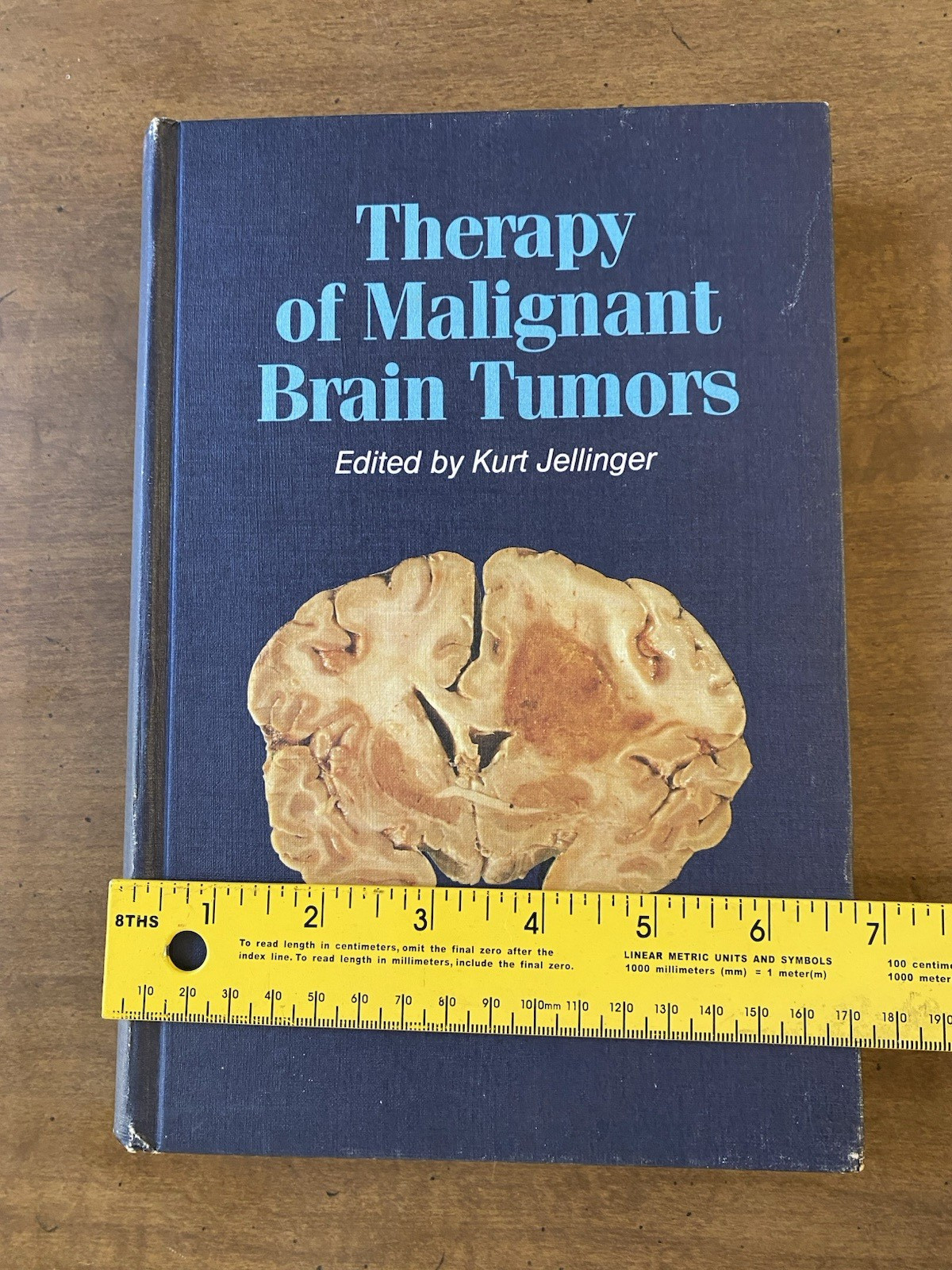 “Therapy of Malignant Brain Tumors” Medical HC 1987 Kurt Jellinger Springer
