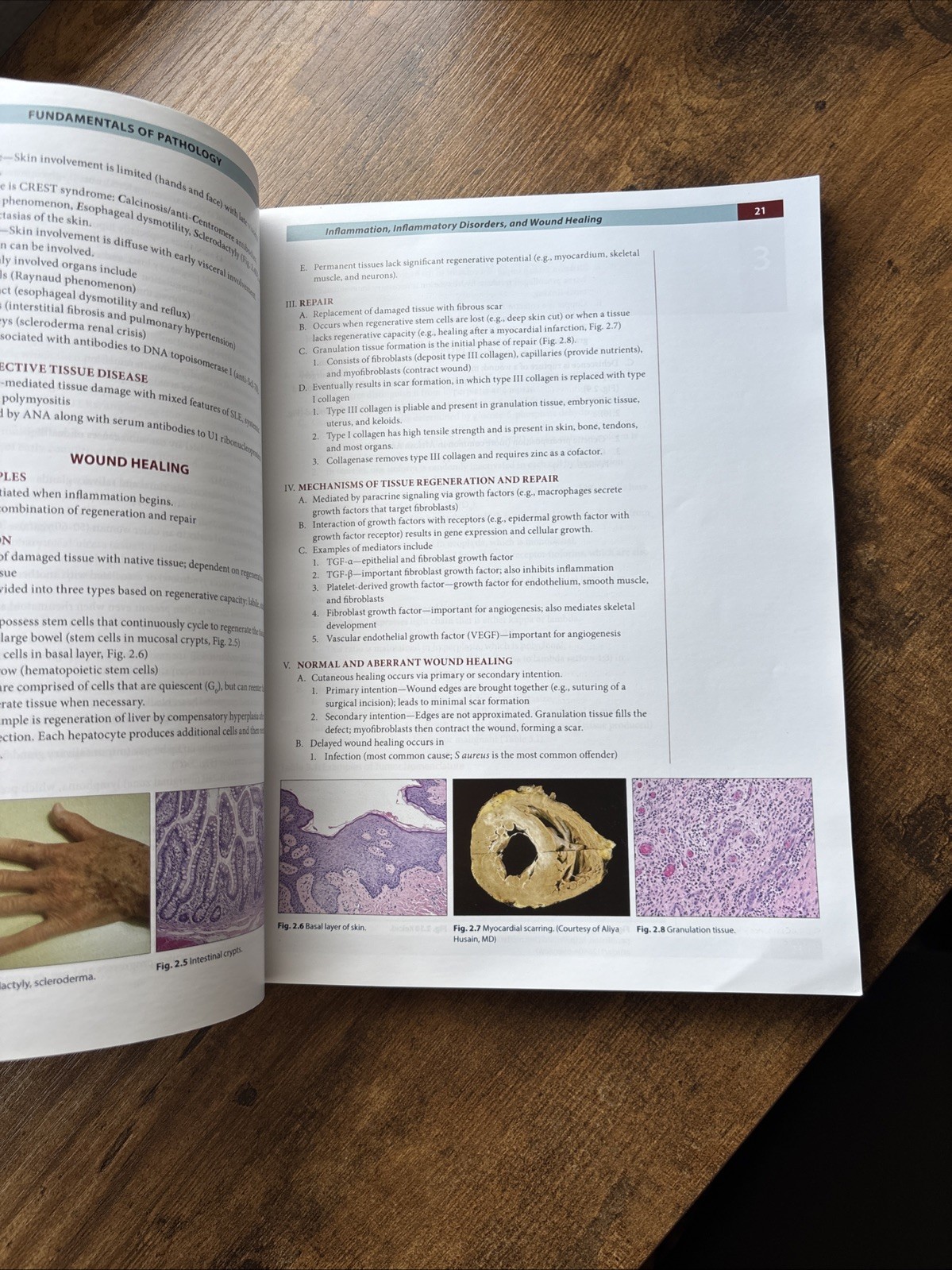 Fundamentals of Pathology 2022 by Hussain A. Sattar Illustrated Medical Textbook