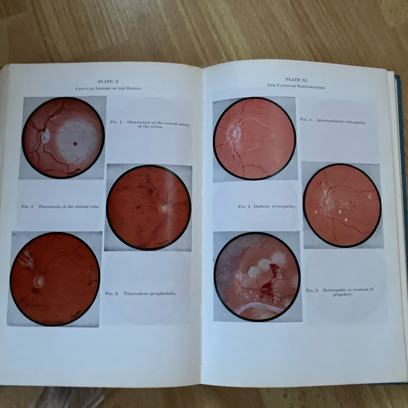 Parsons’ Diseases of the Eye vintage textbook hardback by S. Miller 1978 16th