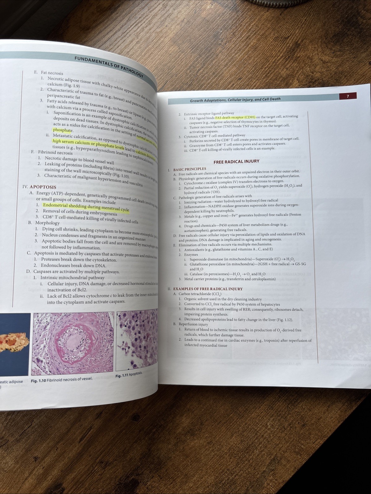 Fundamentals of Pathology 2022 by Hussain A. Sattar Illustrated Medical Textbook