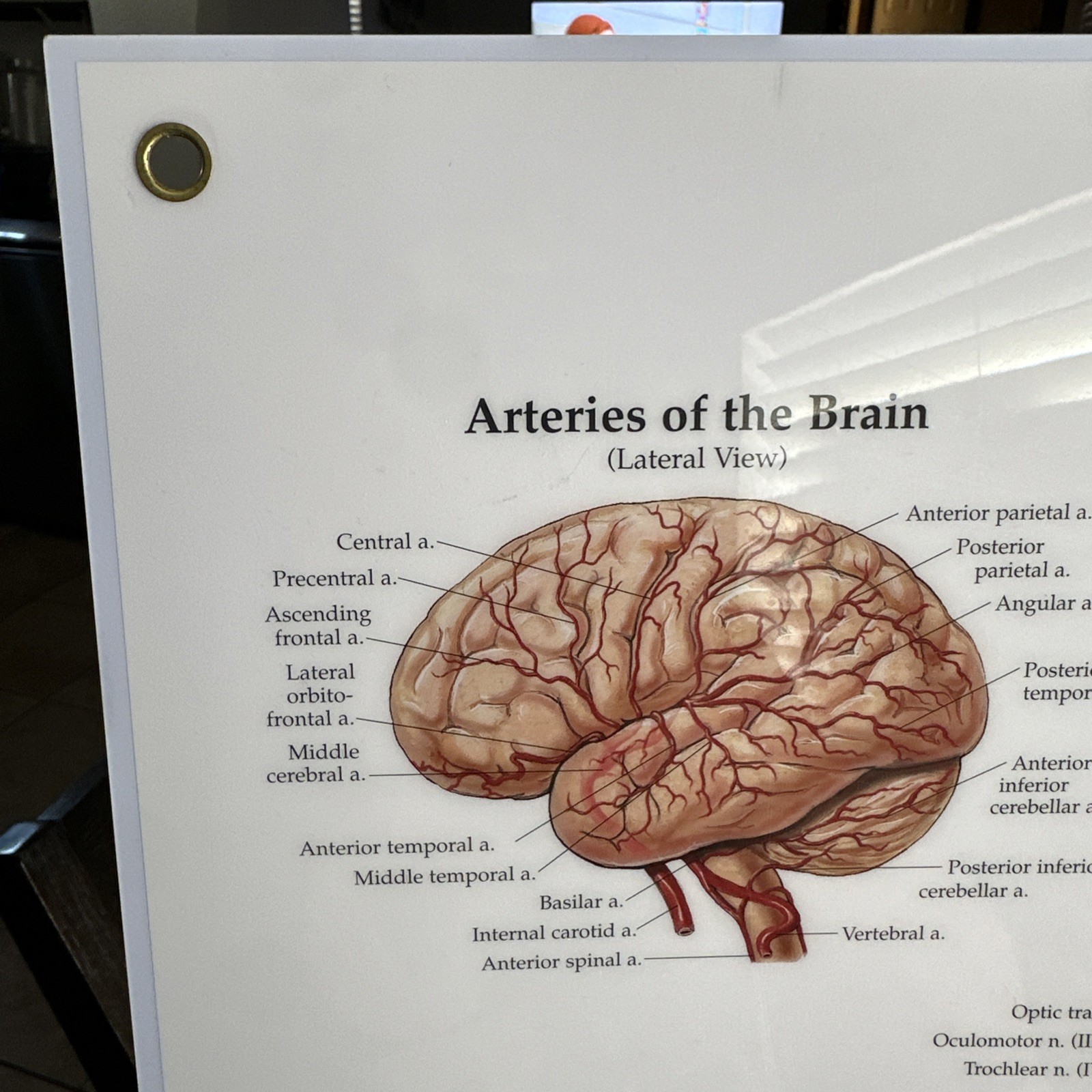 The Brain 3D Raised Relief Chart by Anatomical Chart Company (2004, Wallchart)