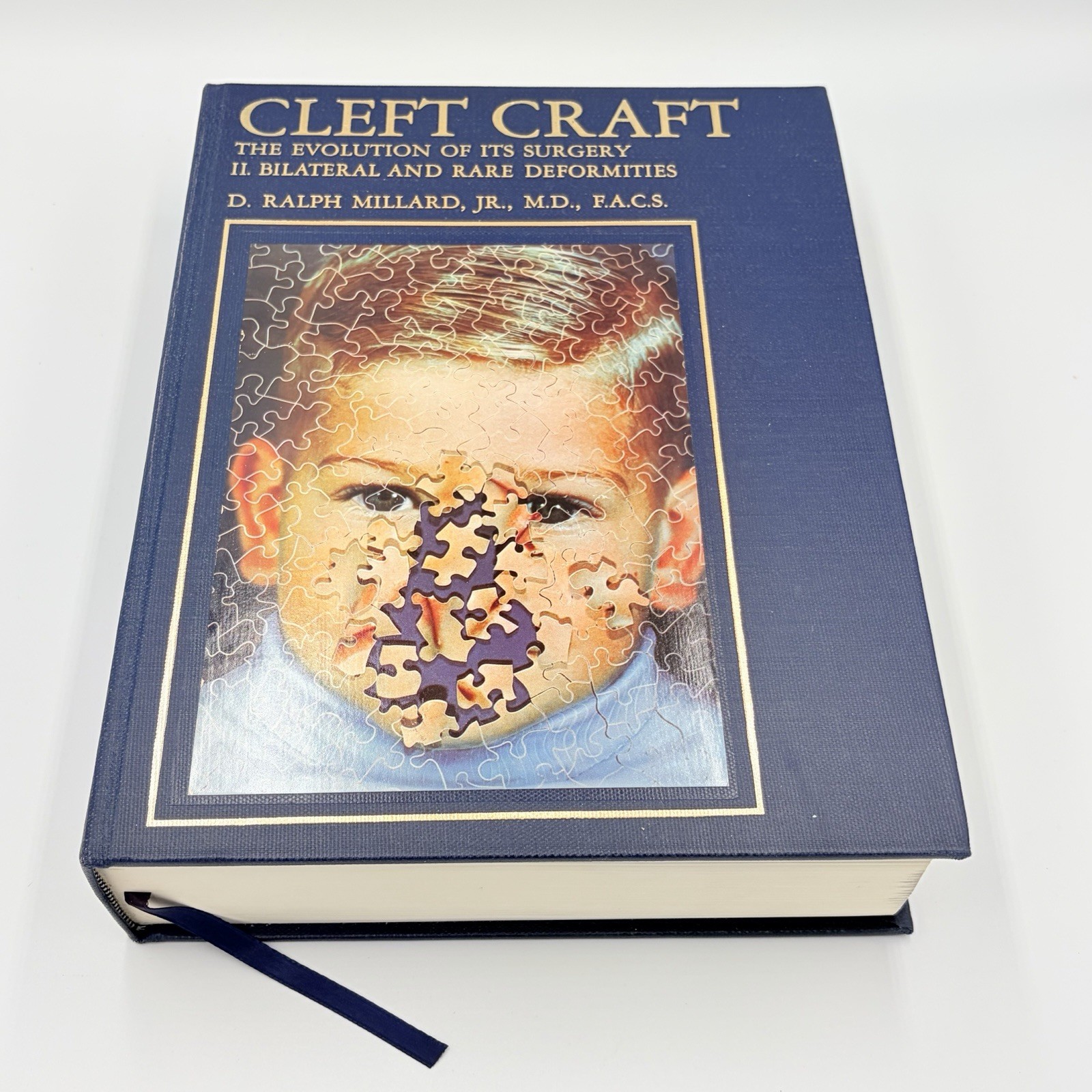 Cleft Craft Vol 2 Evolution Of Its Surgery The Unilateral Deformity Millard 1977