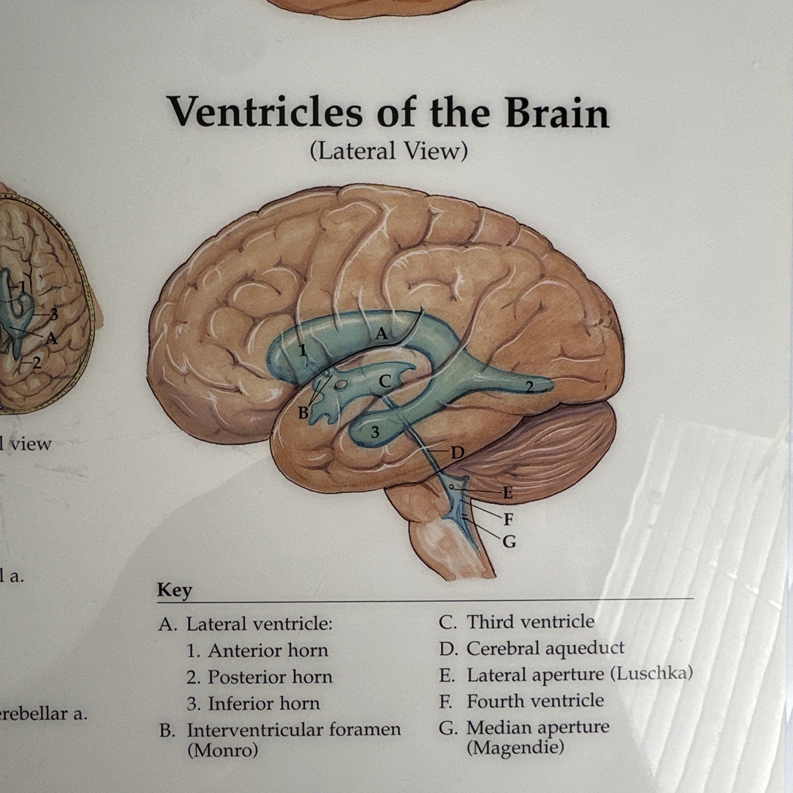 The Brain 3D Raised Relief Chart by Anatomical Chart Company (2004, Wallchart)