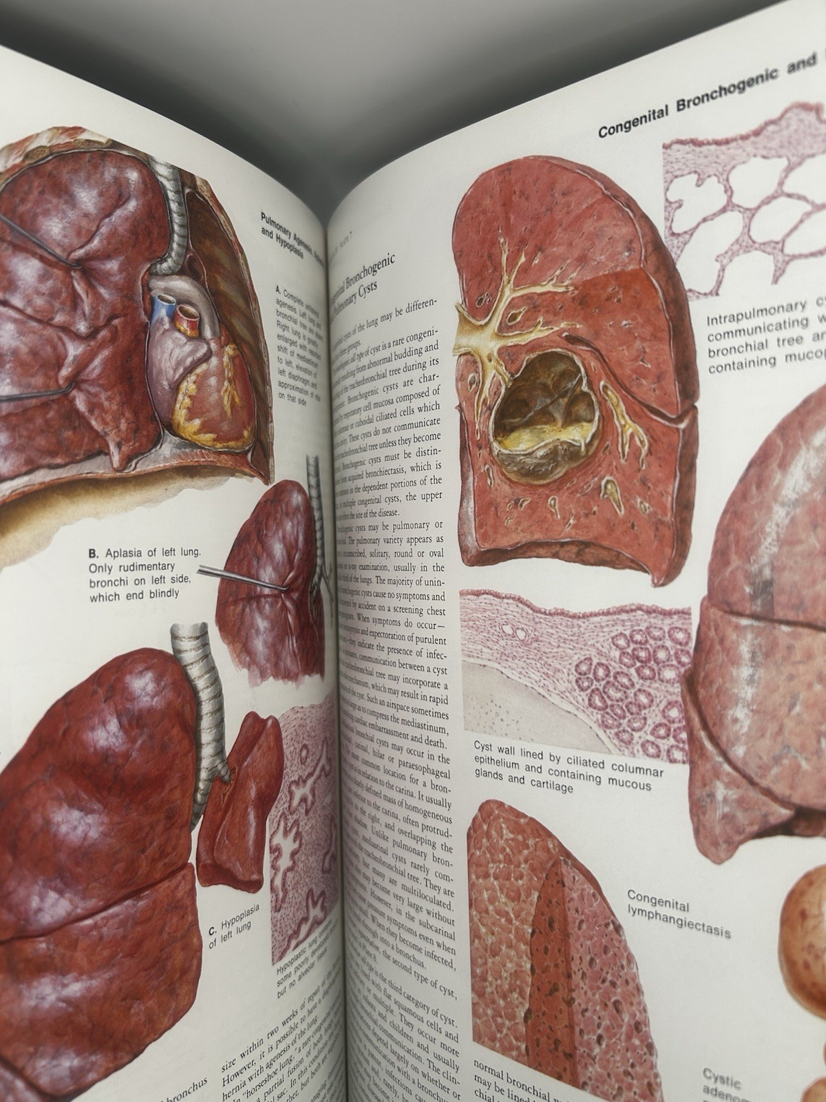 The CIBA Collection Vol 7 Respiratory System Frank H Netter Hardcover New Sealed