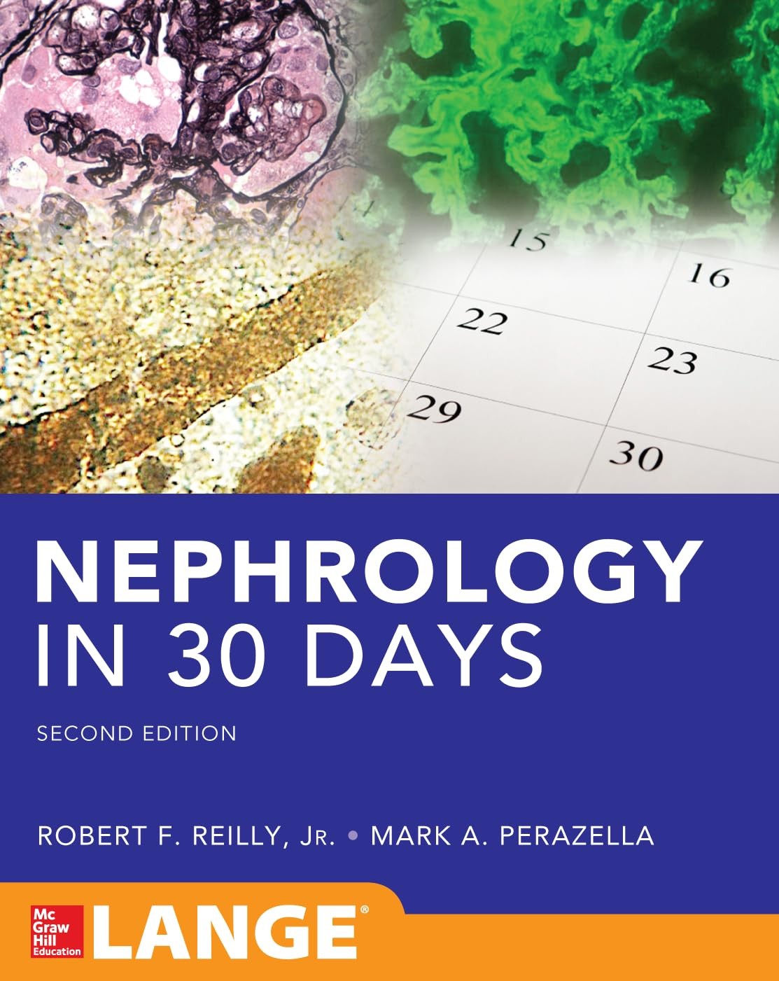 Nephrology in 30 Days by Robert Reilly