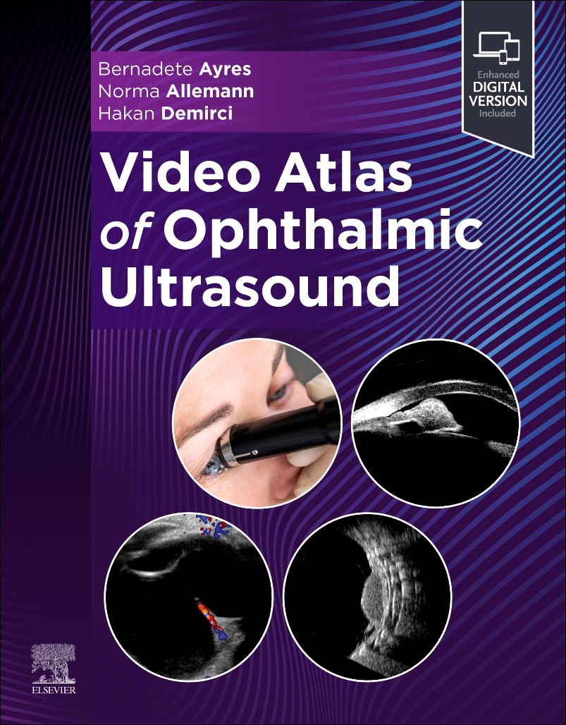 Video Atlas of Ophthalmic Ultrasound