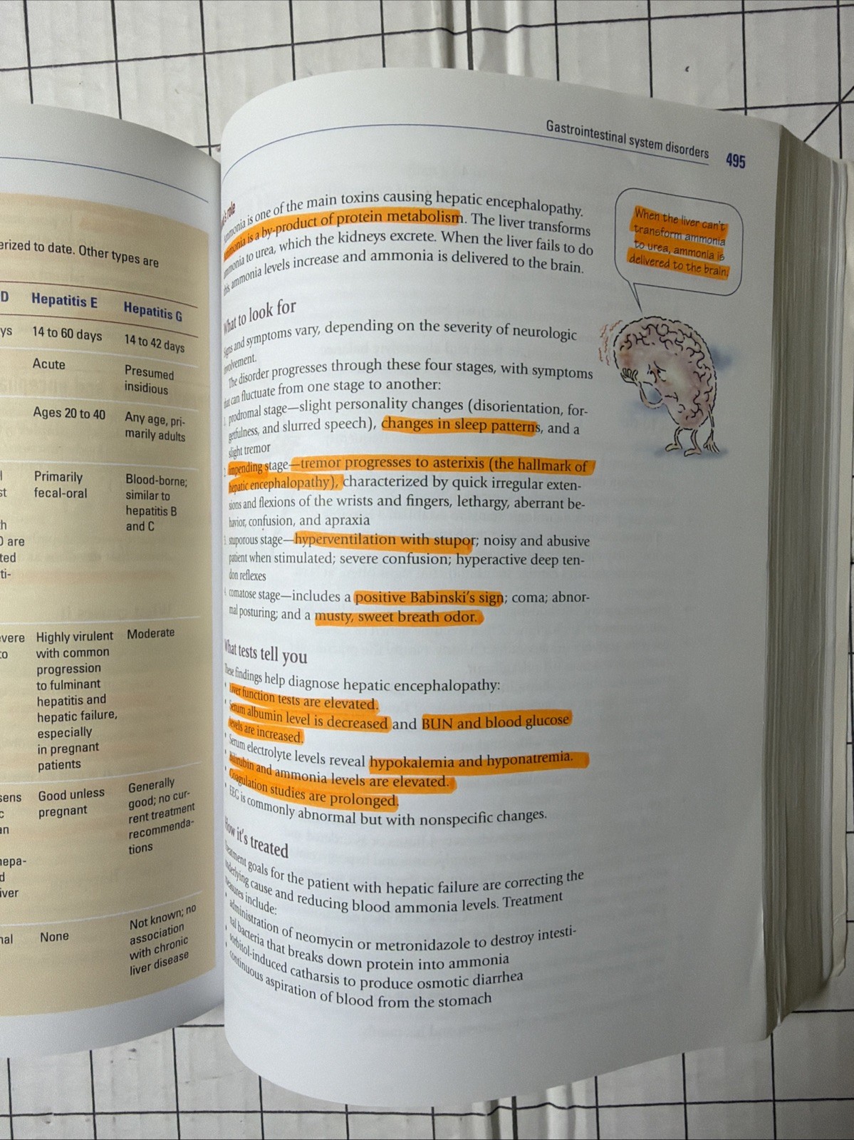 Critical Care Nursing Made Incredibly Easy Woodruff 4th Wolters Kluver CCRN Text