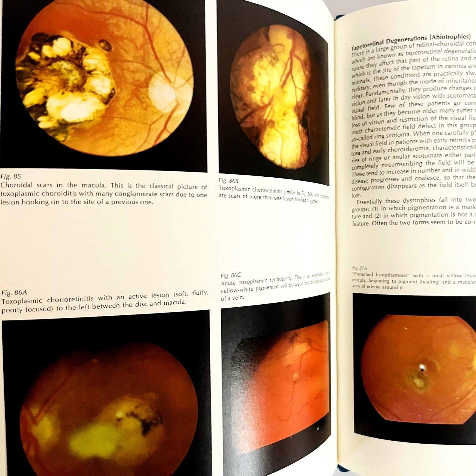 Vintage Monograph on the Fundamentals of Ophthalmoscopy Book Hardcover 1971