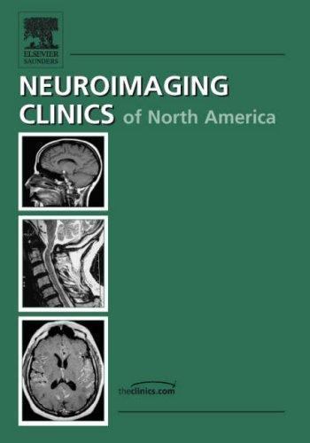 Neuroimaging:3.0t vs. 1.5t, An Issue of Neuroimaging Clinics (Volume 16-2) (…