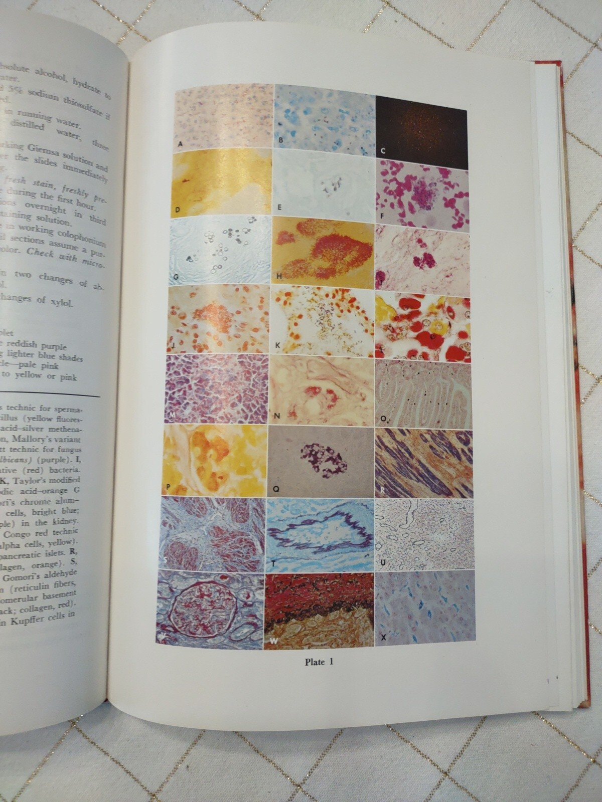 Theory and Practice of Histotechnology by Sheehan & Hrapchak 1973 Illust. 1st Ed