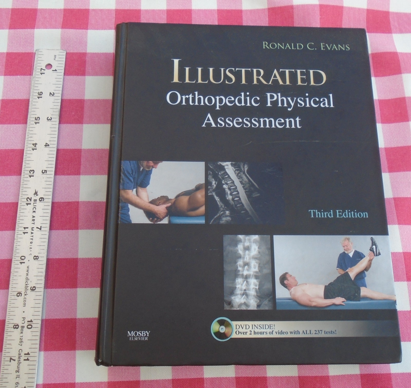 Illustrated Orthopedic Physical Assessment 3rd Edition By Ronald C. Evans
