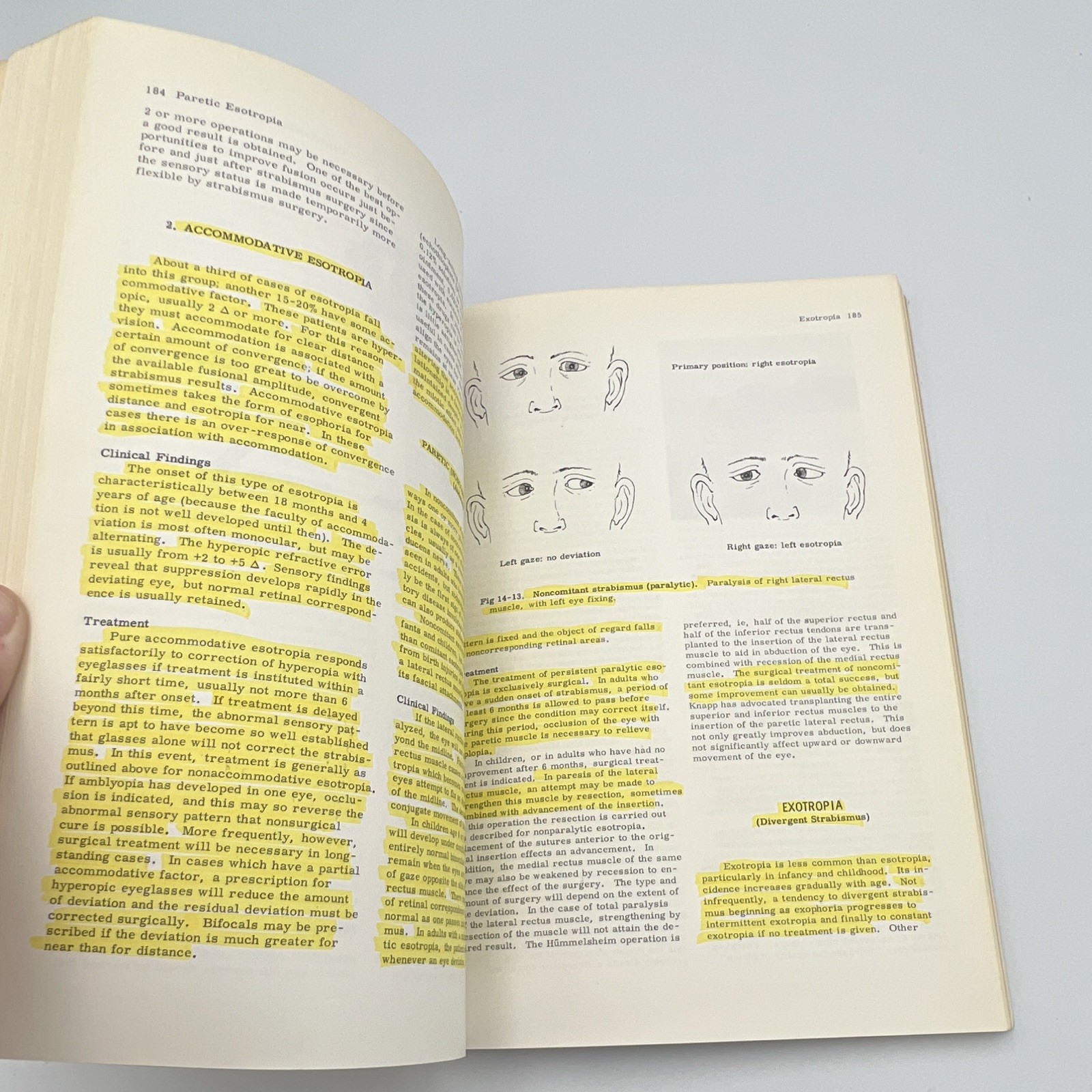 Lange Medical Publications General Ophthalmology 6th Ed 1971 Vaughan Asbury