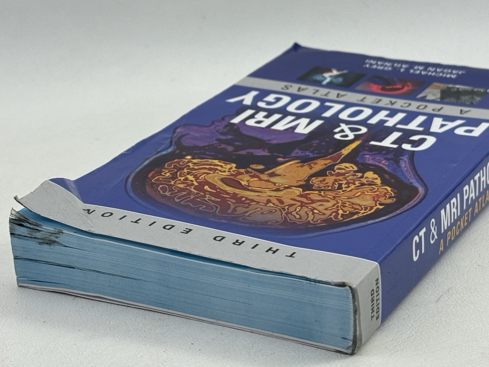 CT & MRI Pathology: A Pocket Atlas, Third Edition – Paperback, by GREY