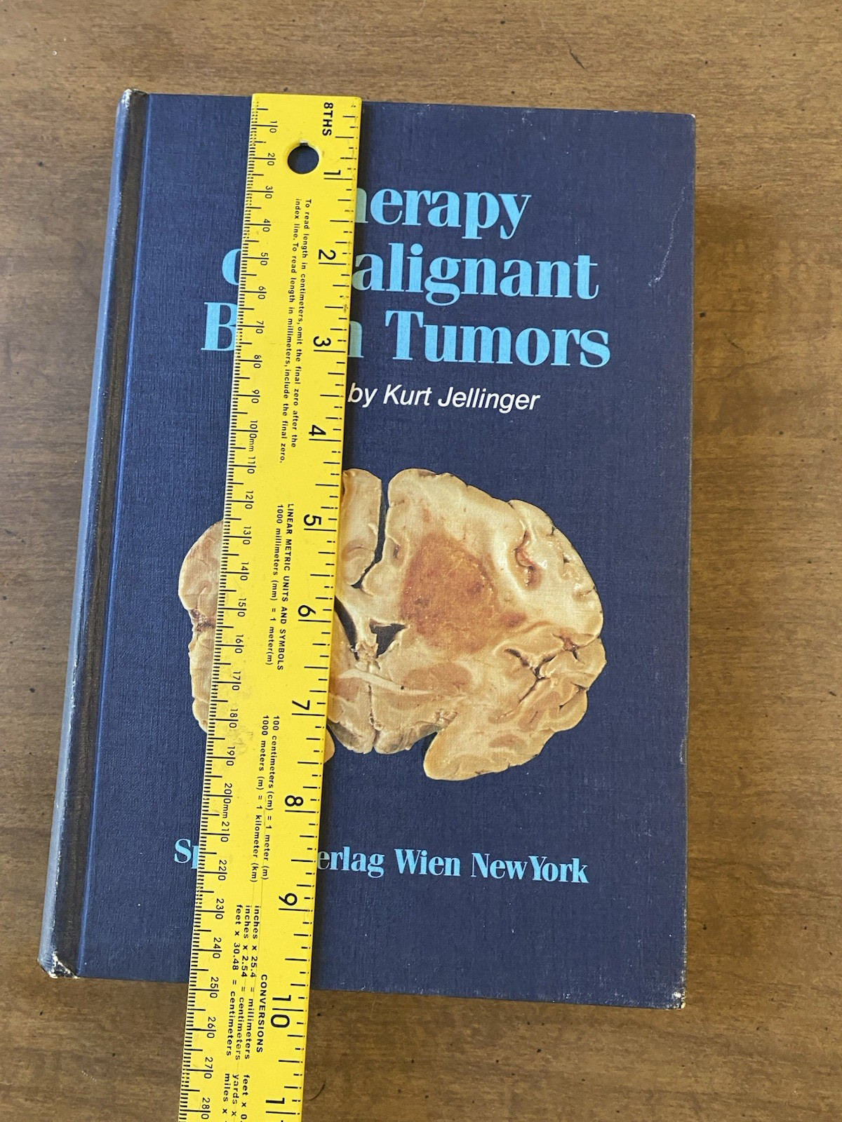“Therapy of Malignant Brain Tumors” Medical HC 1987 Kurt Jellinger Springer