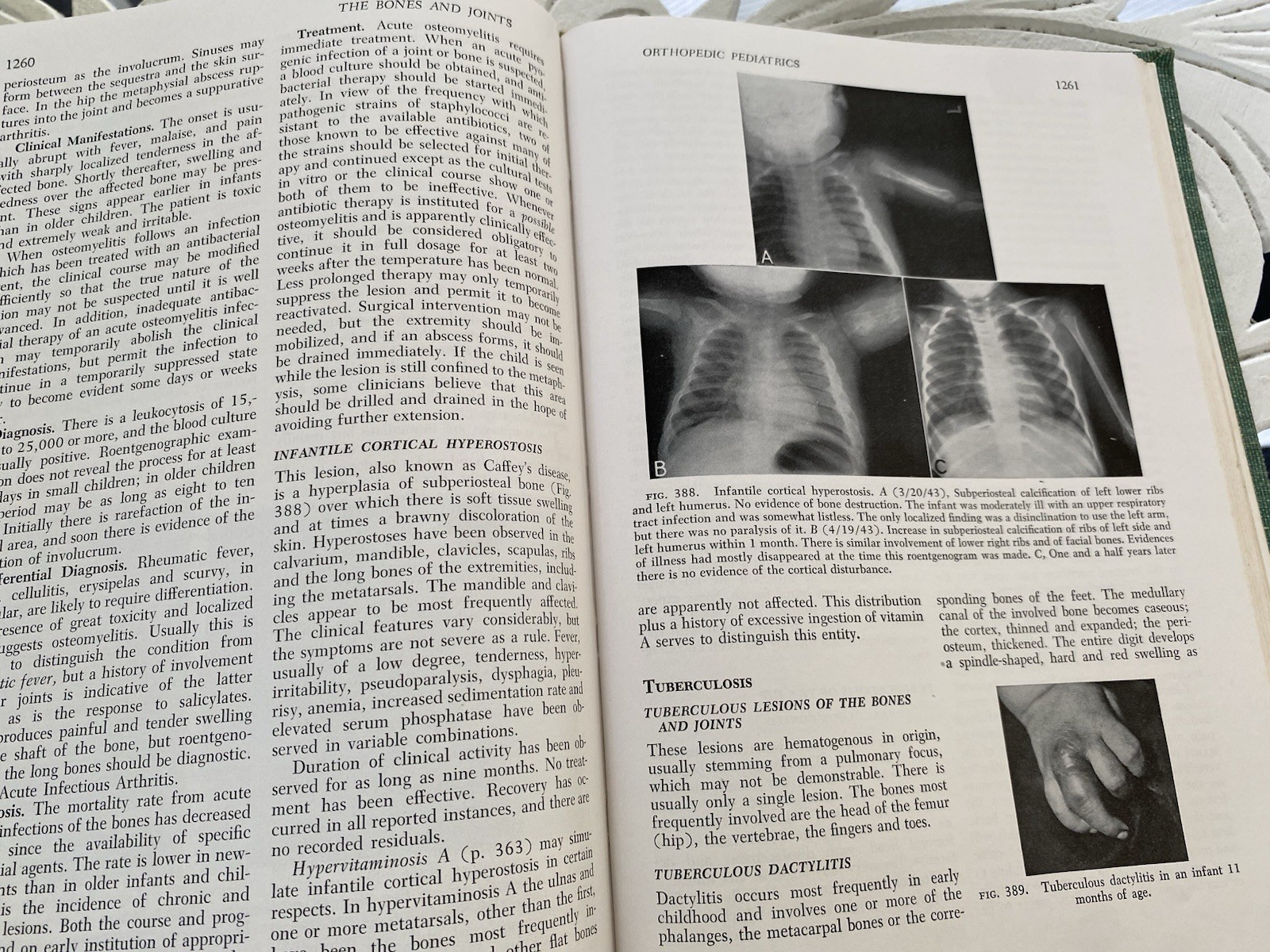Vintage Medical Book: Textbook of Pediatrics Waldo Nelson W B Saunders 1959