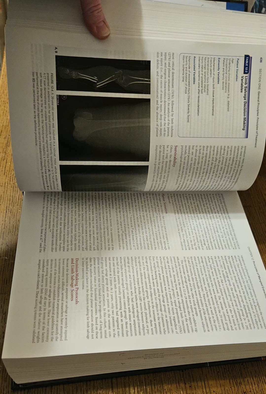 Rockwood and Green’s Fractures In Adults, Eighth Edition, Volumes 1 & 2