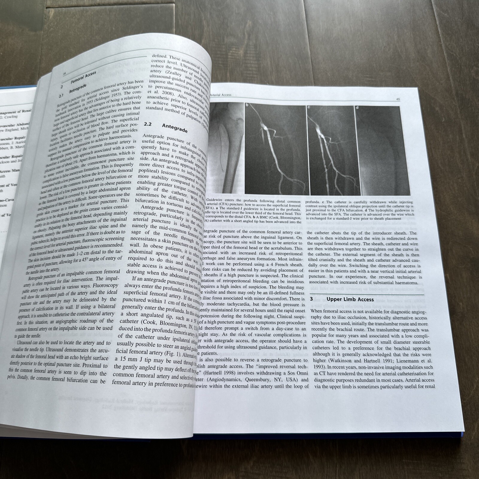 Vascular Interventional Radiology Current Evidence in Endovascular Surgery 2nd