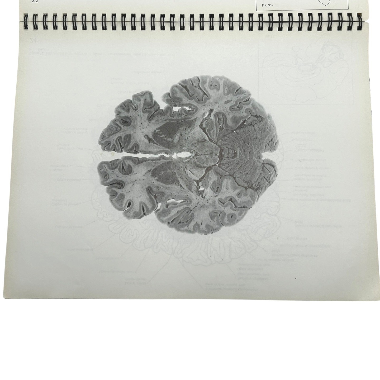 Structure of the Human Brain A Photographic Atlas Third Edition Textbook