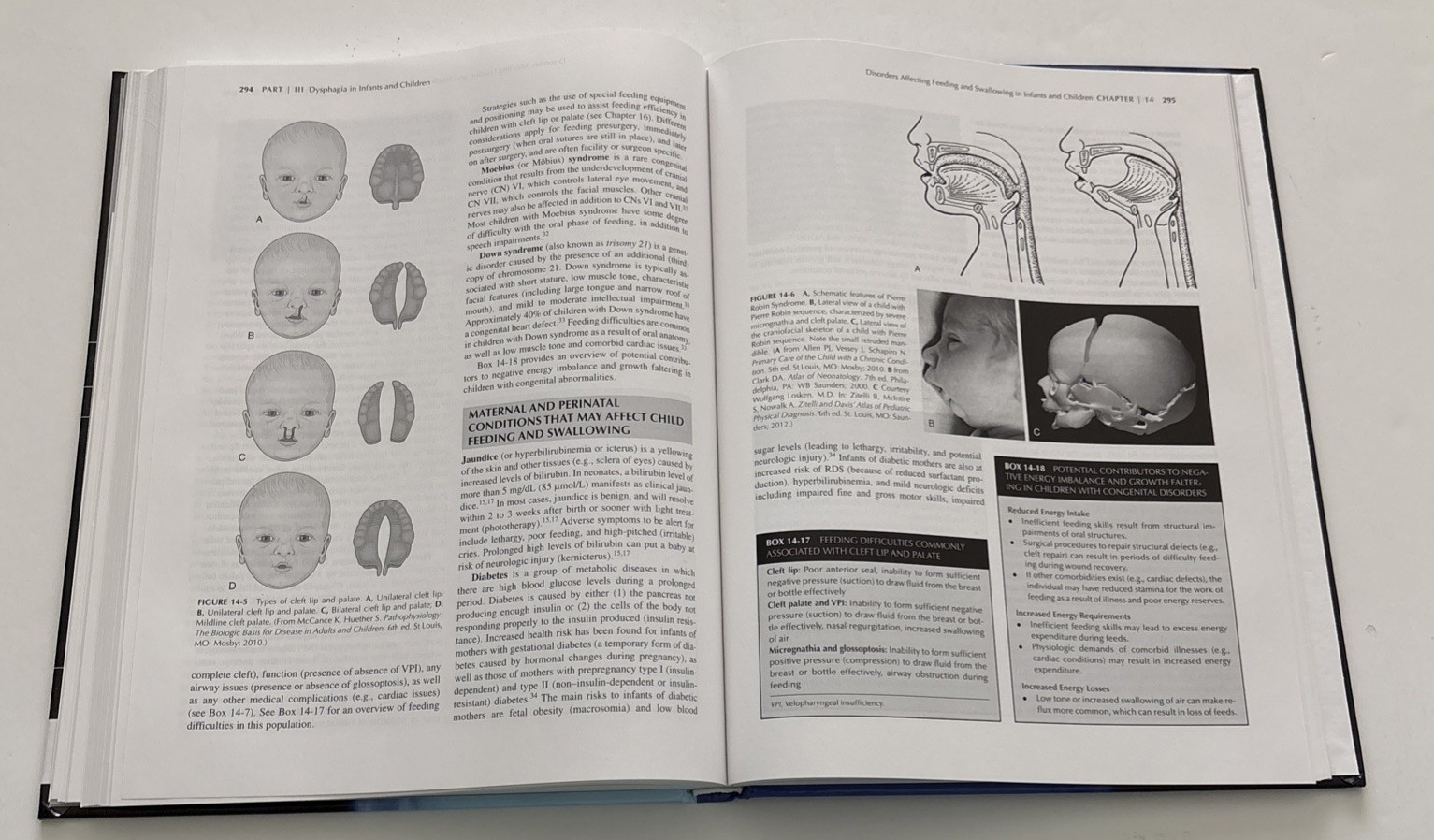Dysphagia Clinical Management In Adults And Children; Third Edition