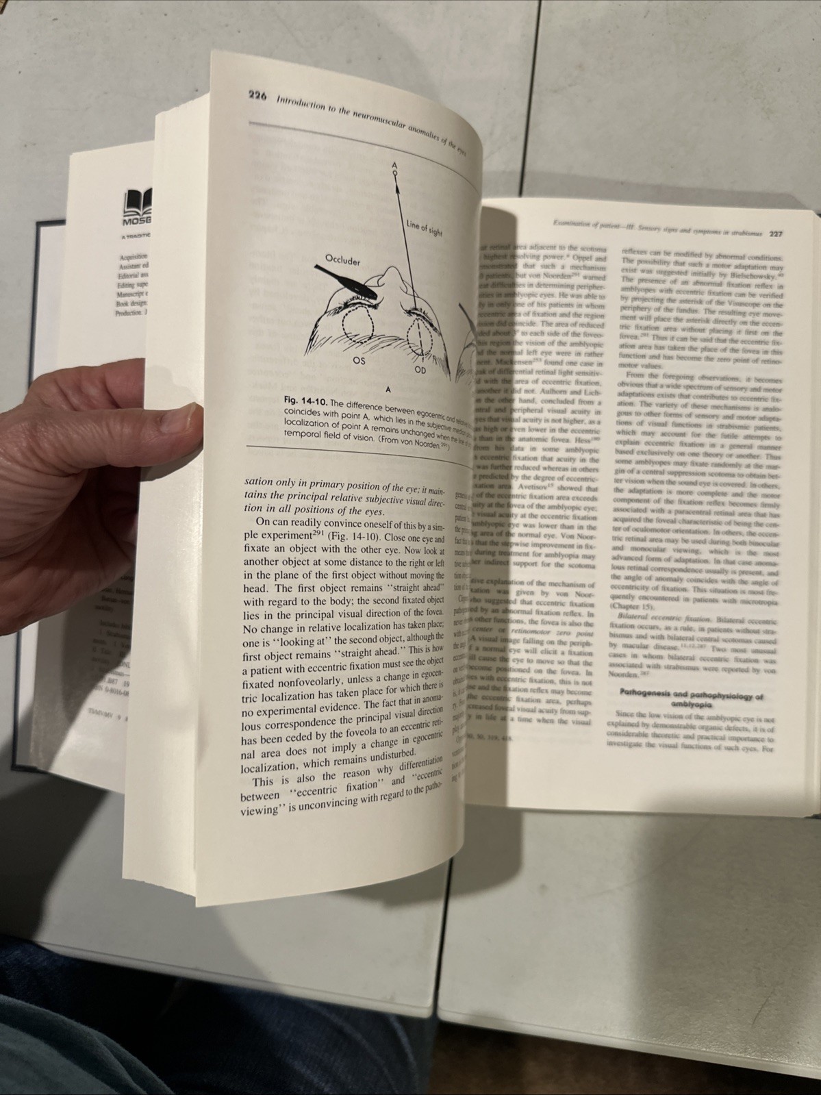 Binocular Vision And Ocular Motility. Von Noorden. 1985. Ophthalmology