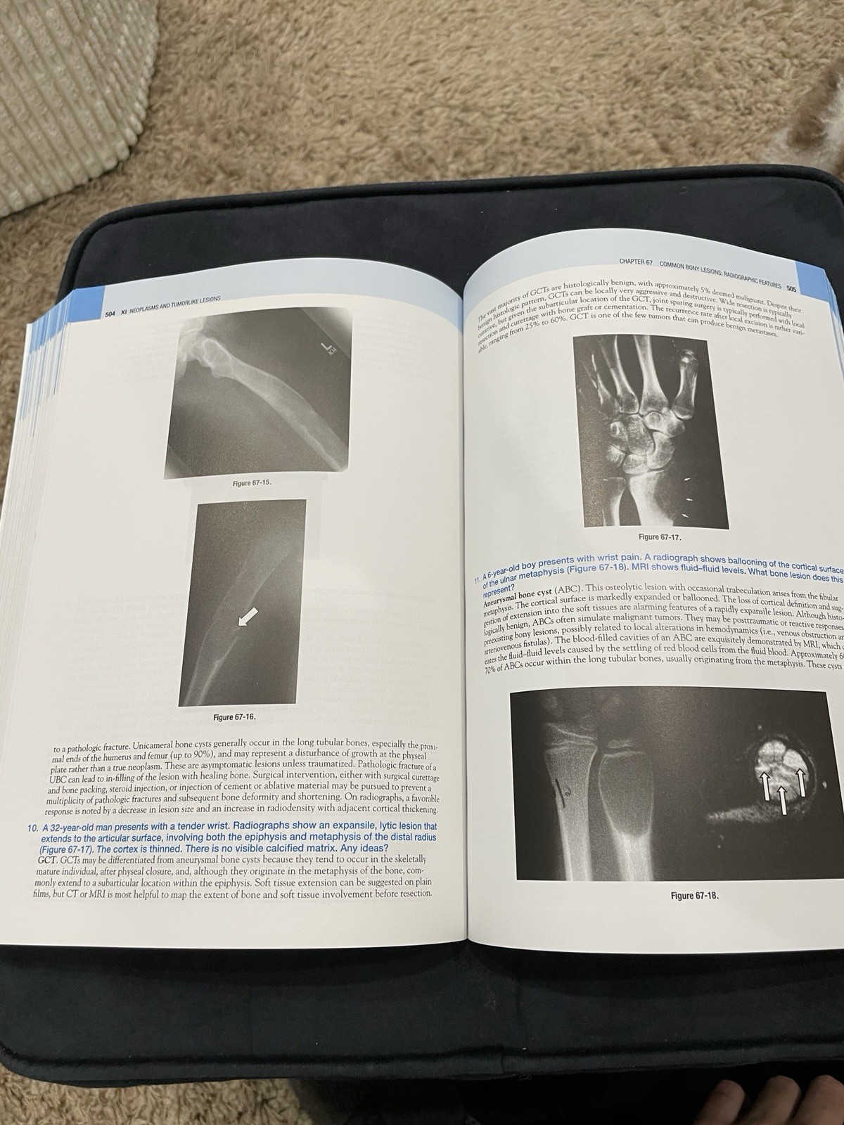 Rheumatology Secrets by Sterling West, 3rd Edition