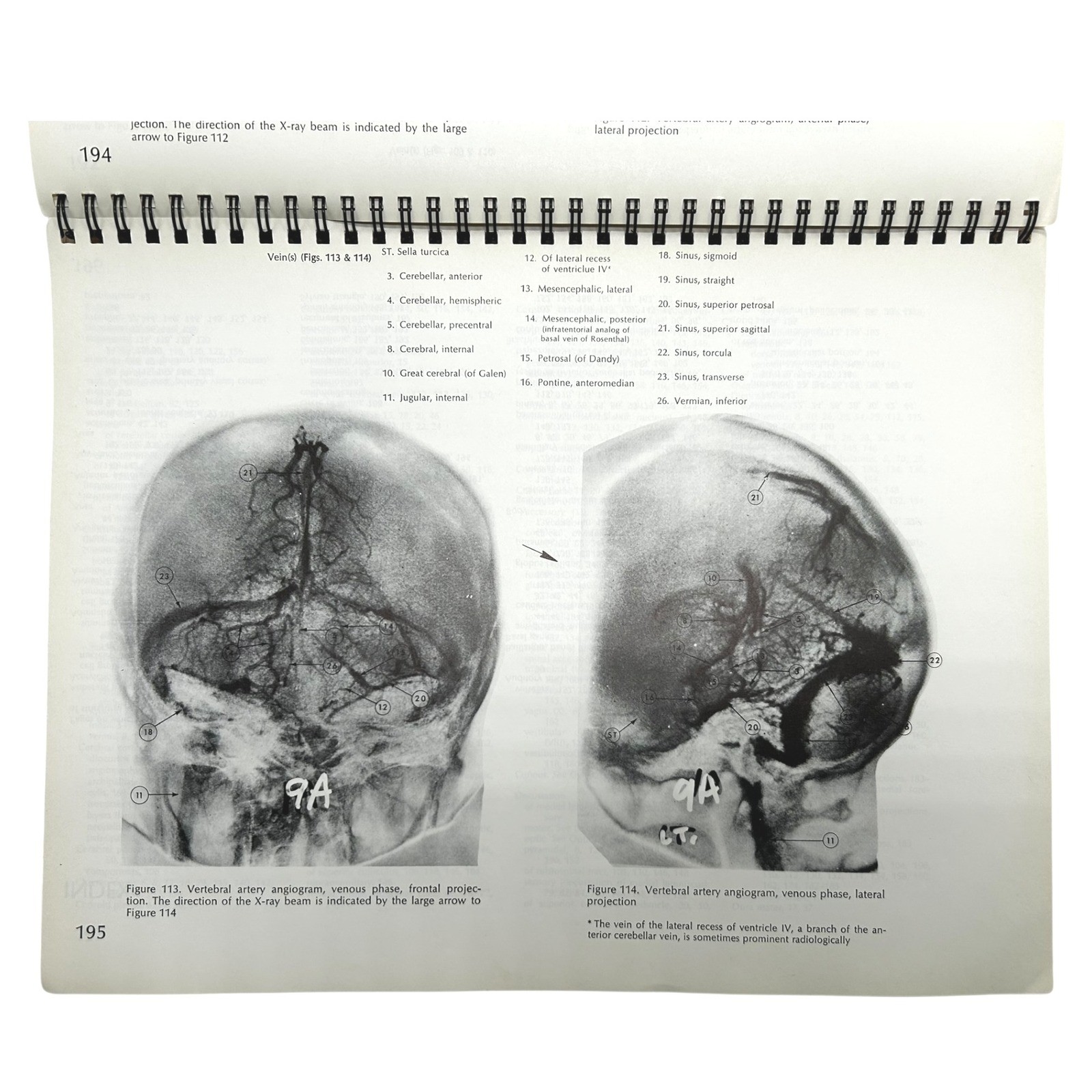 Structure of the Human Brain A Photographic Atlas Third Edition Textbook
