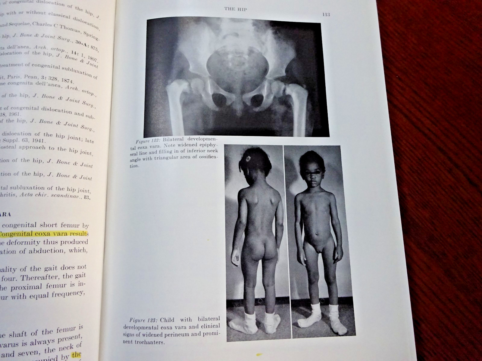 The Surgery of Infancy and Childhood 1963 Hard Cover with index 650 pages