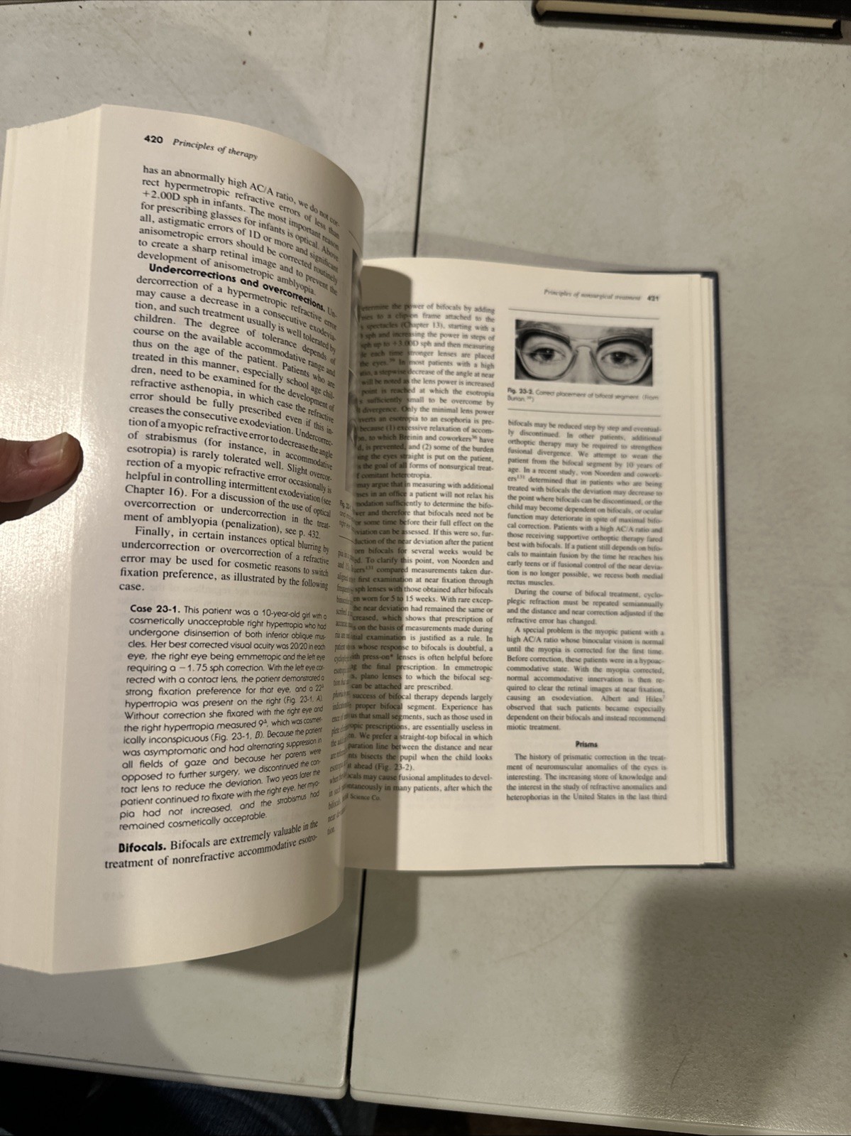 Binocular Vision And Ocular Motility. Von Noorden. 1985. Ophthalmology