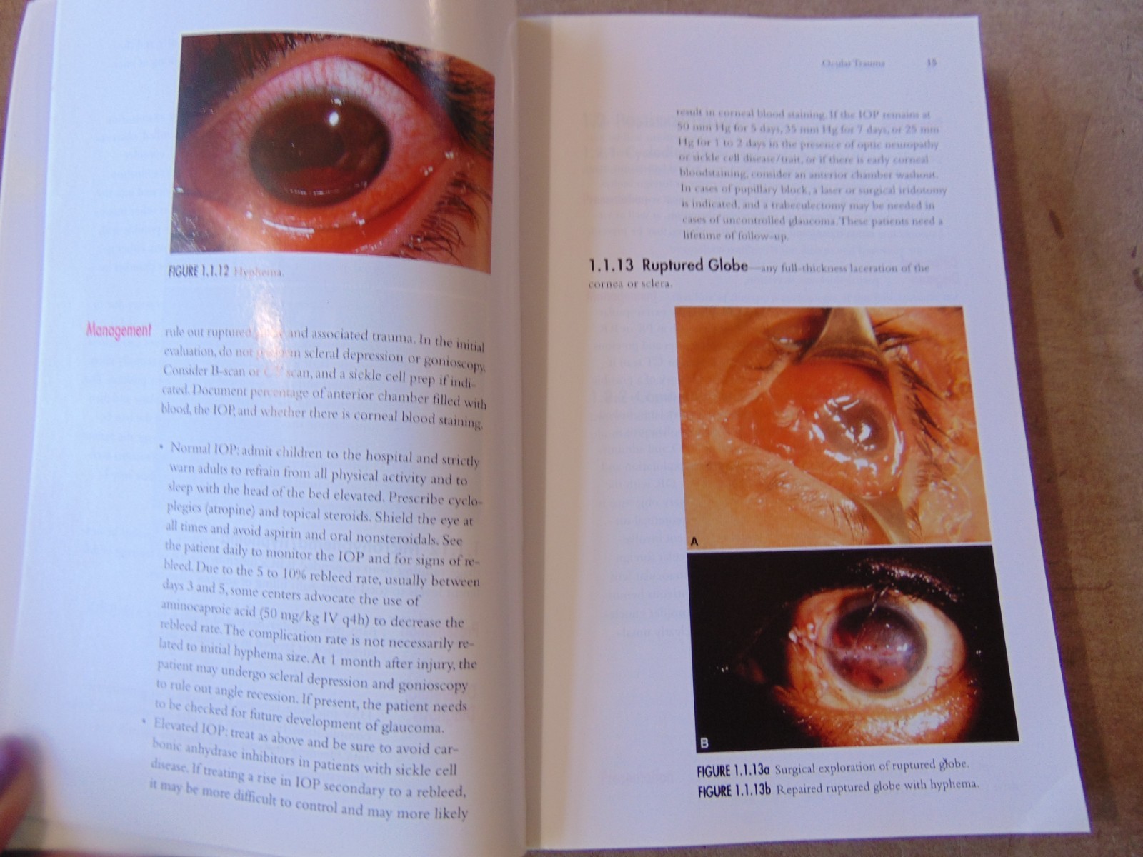 Color Atlas of Ophthalmology Mandava 1999 Manhattan eye ear throat pocket guide