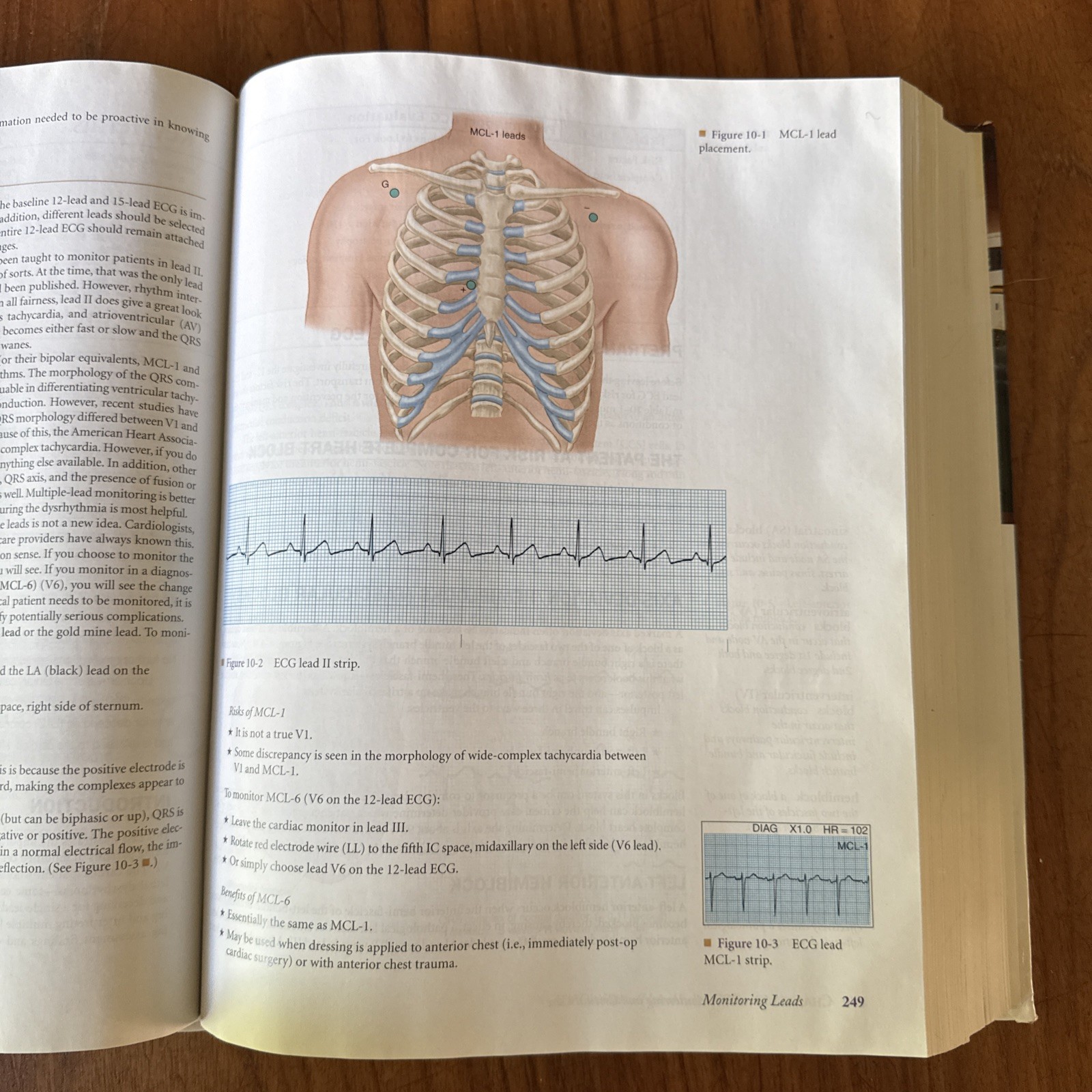 Brady Critical Care Paramedic Textbook GOOD 9780131192713