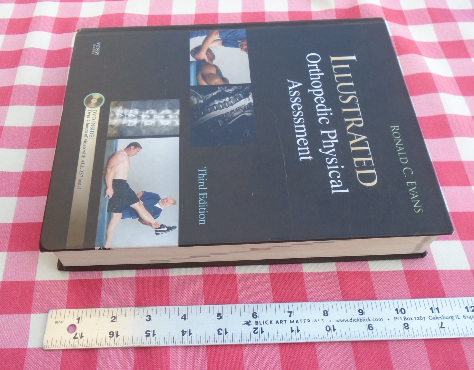 Illustrated Orthopedic Physical Assessment 3rd Edition By Ronald C. Evans