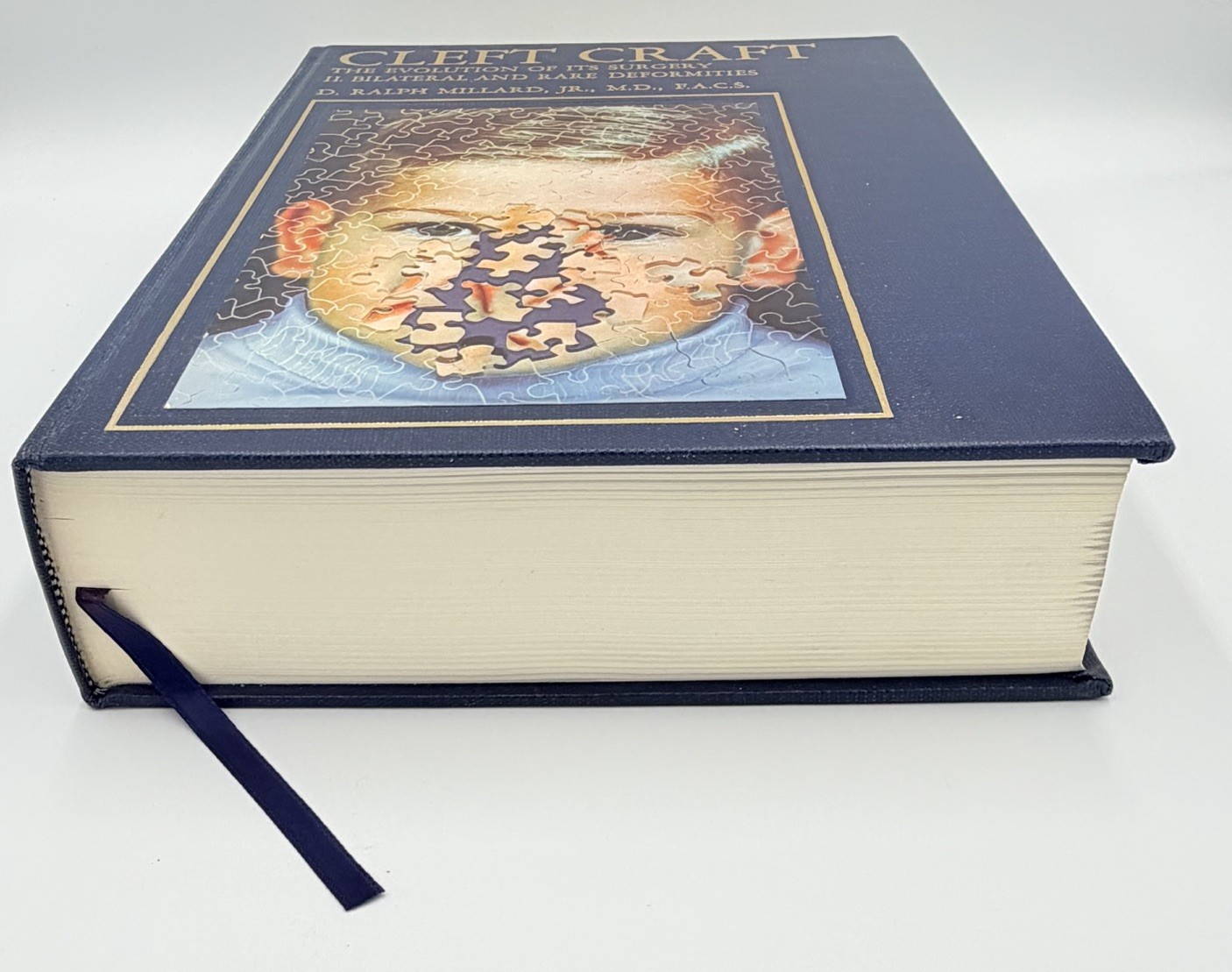 Cleft Craft Vol 2 Evolution Of Its Surgery The Unilateral Deformity Millard 1977