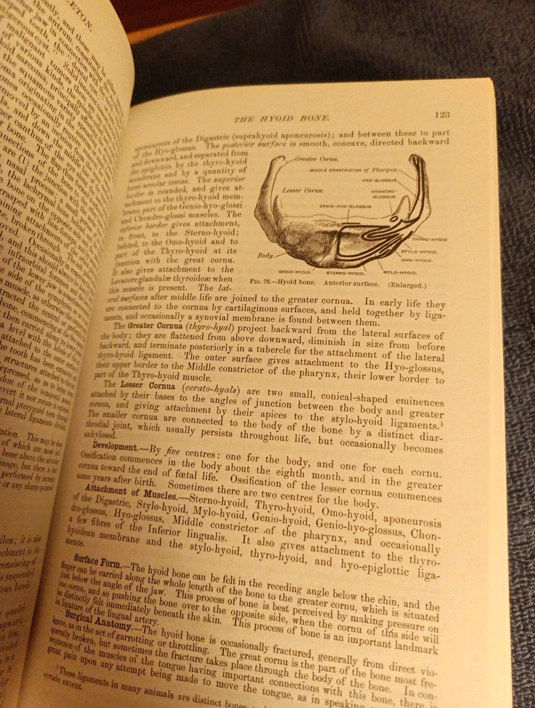 Gray’s Anatomy : The Unabridged Running Press Edition of the American Classic…