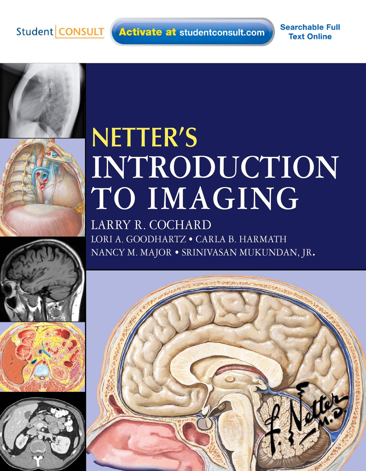 Netter’s Introduction to Imaging: with Student Consult Access (Netter Basic …