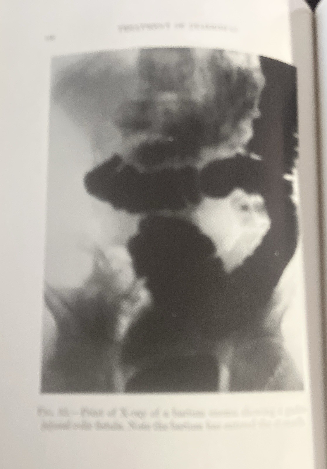Proctoscopic Examination and Diagnosis & Treatment of Diarrheas 1940 Streicher