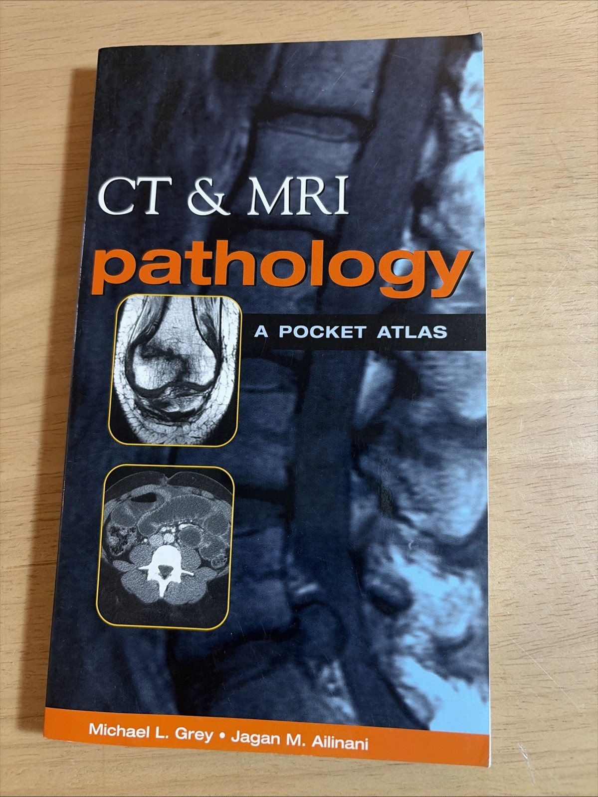 CT & MRI Pathology: A Pocket Atlas by Michael L. Grey; Jagan M. Ailinani