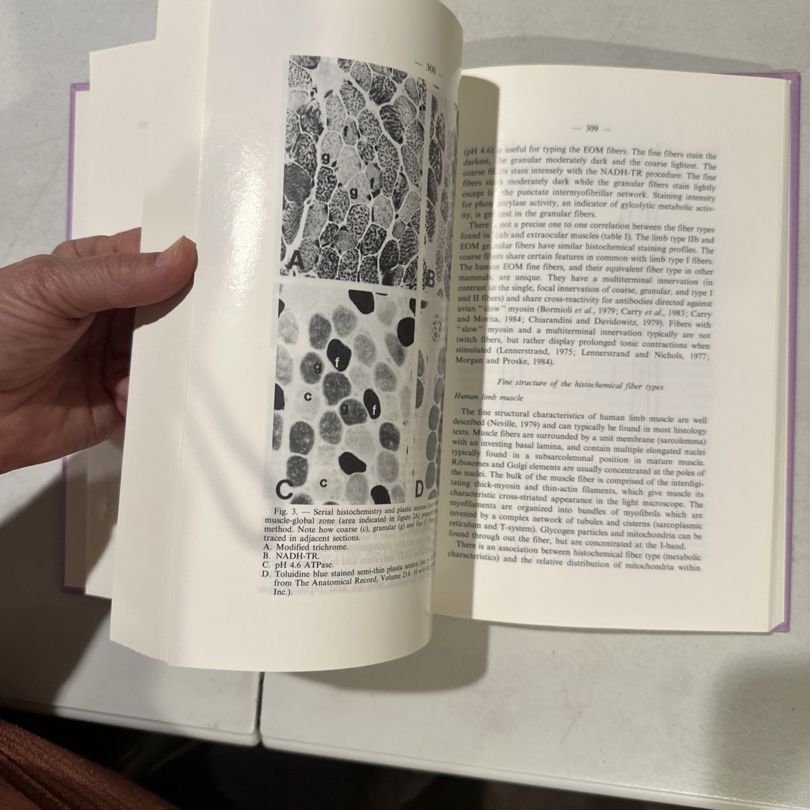 Neurological Organization of Ocular Movement. Ed. Daroff Neetens.Ophthalmology