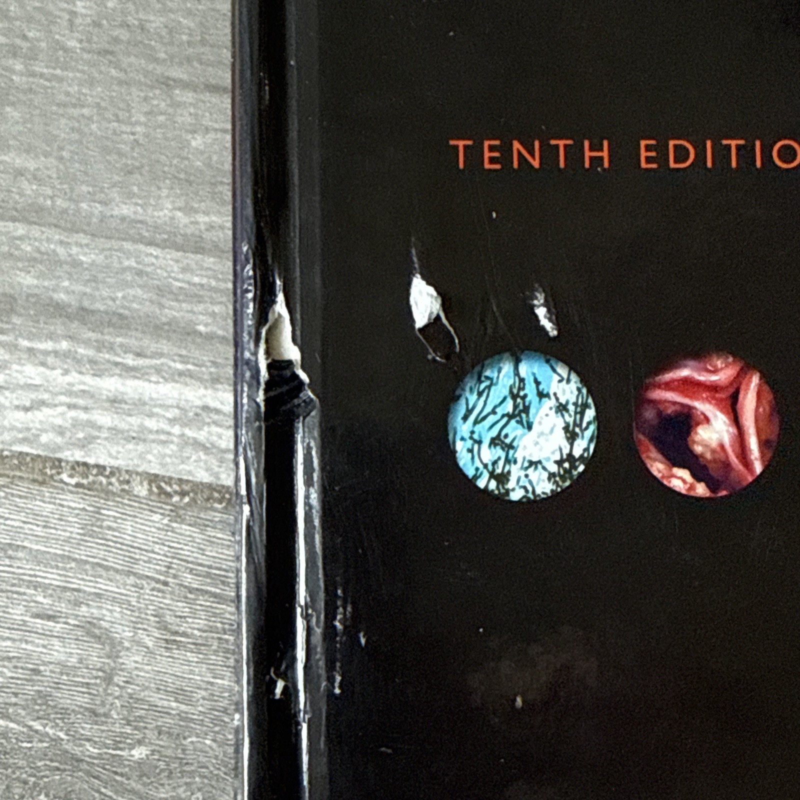 🌟 Robbins Basic Pathology Tenth Edition with Student Consult