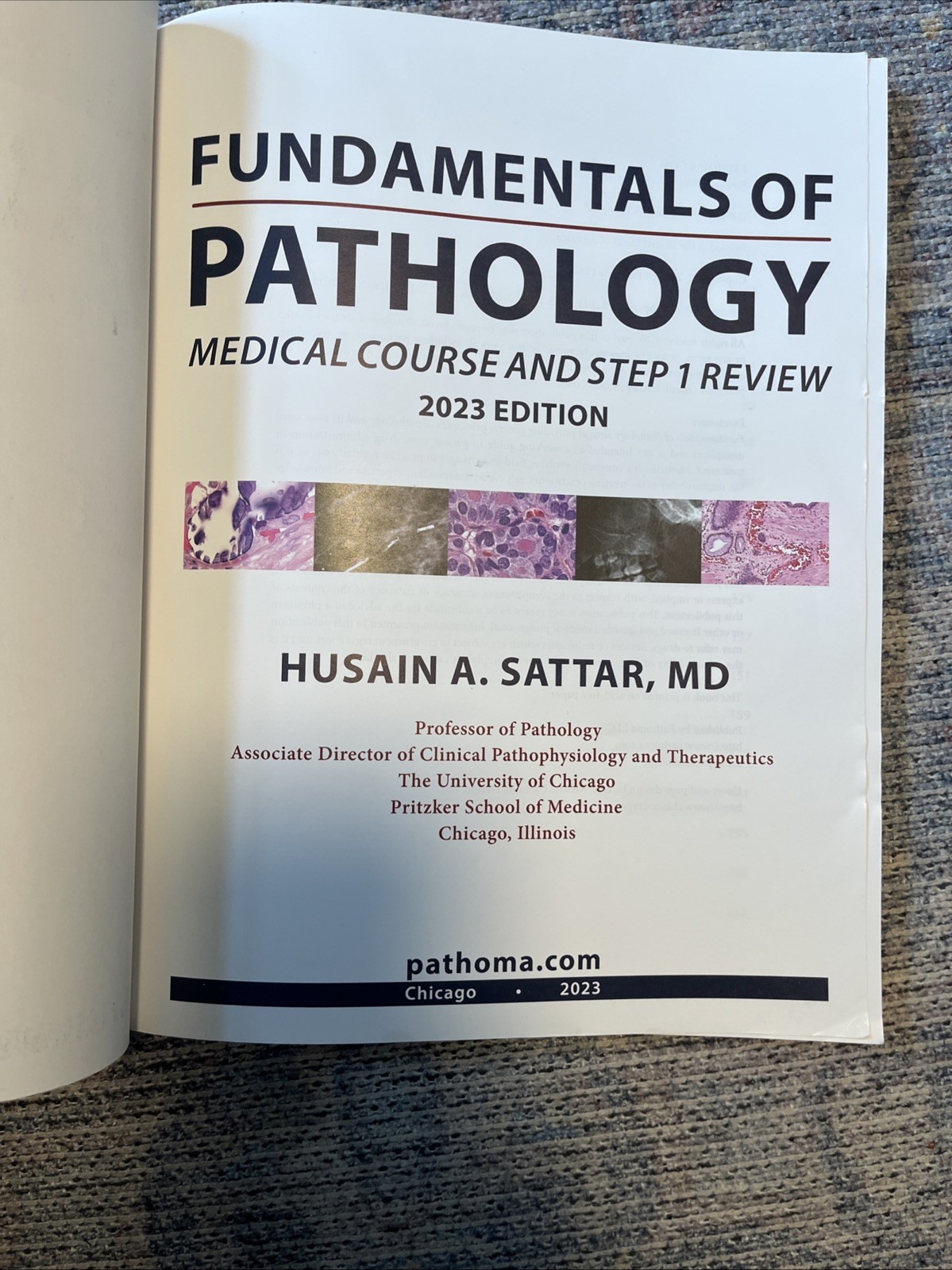 Fundamentals of Pathology – Paperback, by Sattar Husain A. – Acceptable a