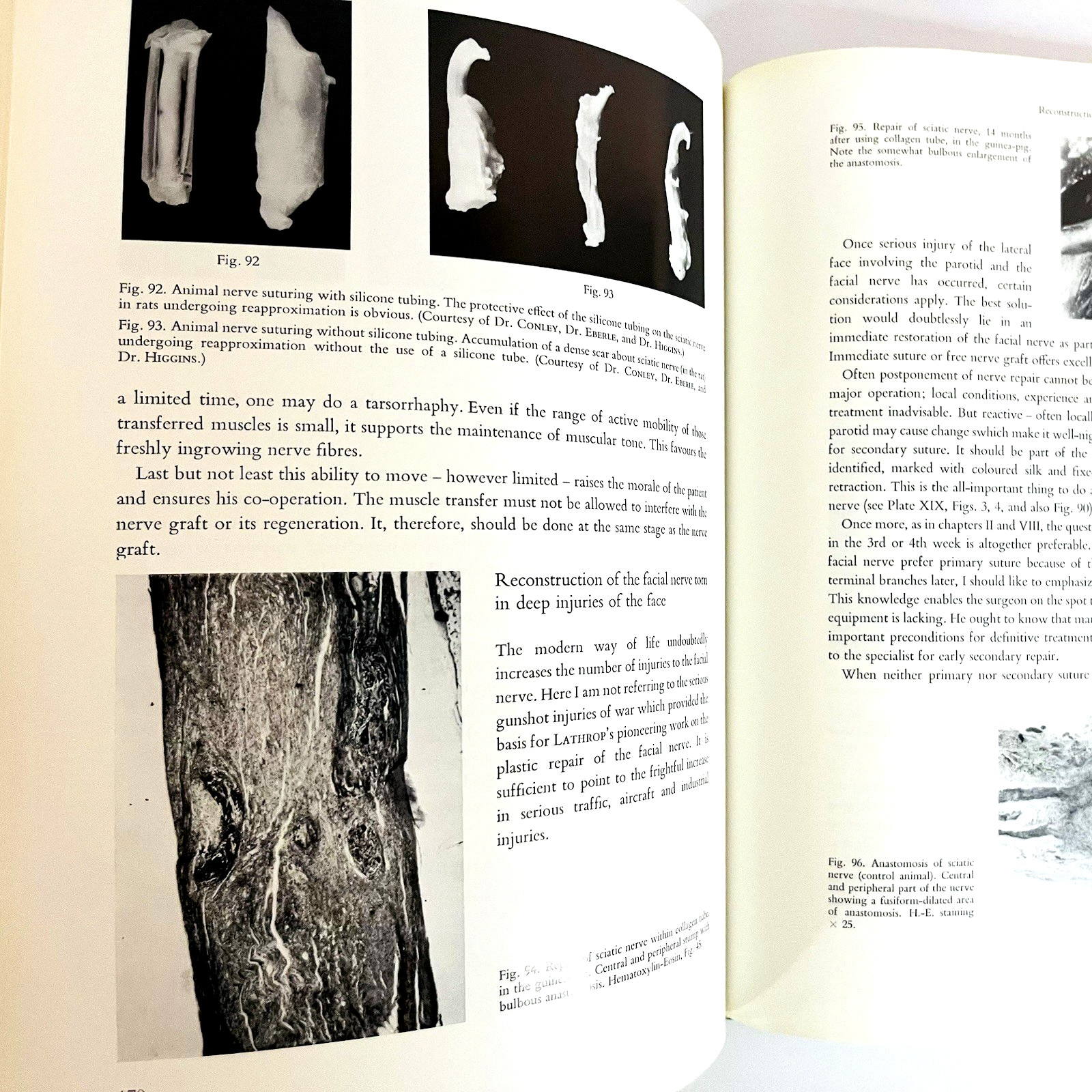Vintage Surgery of The Facial Nerve Book Hardcover Adolf Michlke 1973