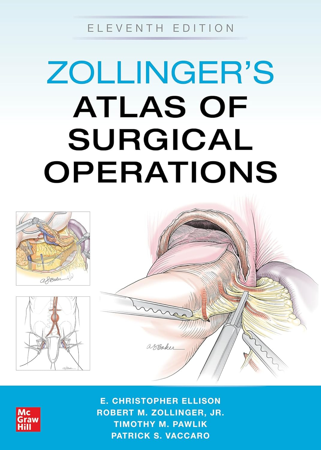 Zollinger’S Atlas of Surgical Operations, Eleventh Edition