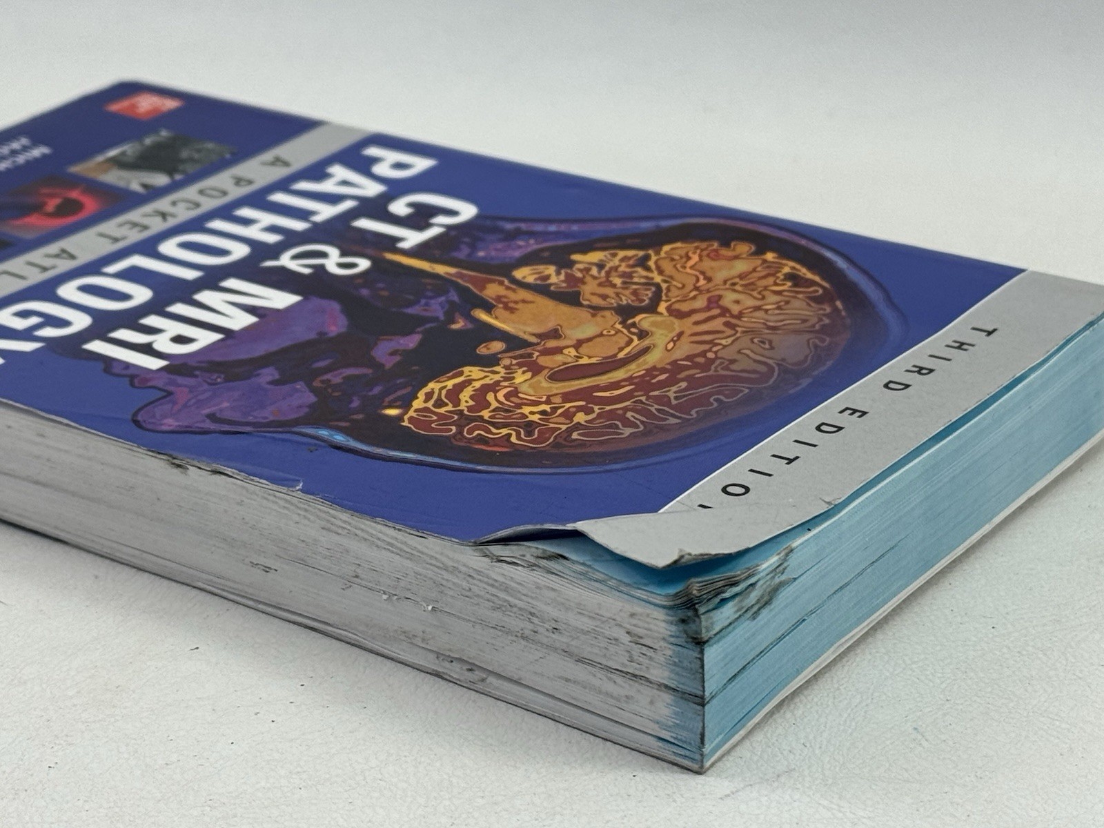 CT & MRI Pathology: A Pocket Atlas, Third Edition – Paperback, by GREY