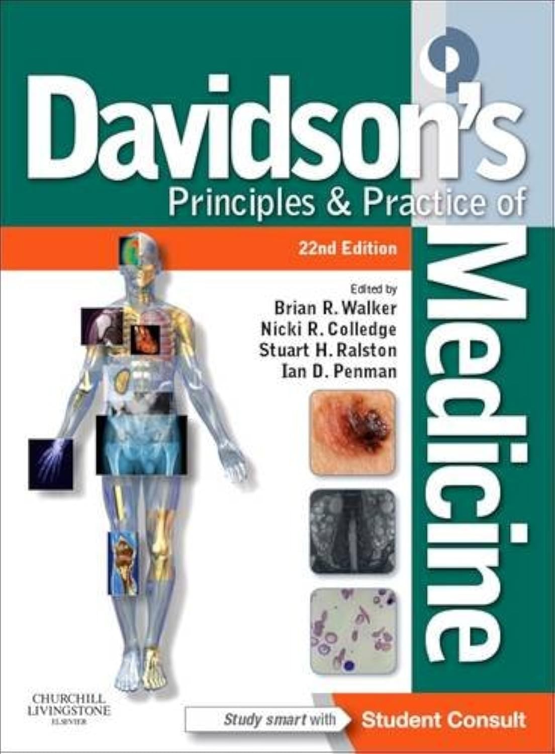 Davidson’s Principles and Practice of Medicine: With STUDENT CONSULT Online …